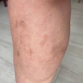 Climed Tedavi Merkezi Climed Varis Şikayeti