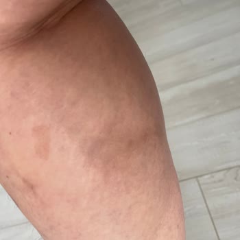 Climed Tedavi Merkezi Climed Varis Şikayeti