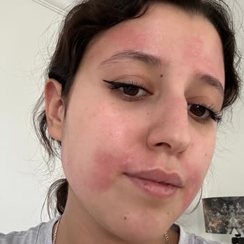 Migros'un Ağda Bantları