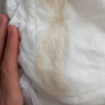Sleepy Beş Numara Bebek Bezi İçinde Naylon Çıkması