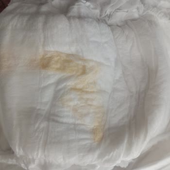 Sleepy Beş Numara Bebek Bezi İçinde Naylon Çıkması