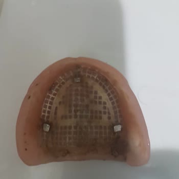 Gisbir Hastanesi Yaşanan Büyük Sorunlar