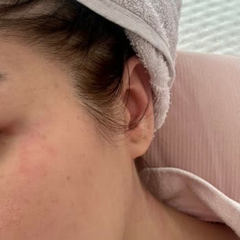 Koleston Naturals Boya Alerji Yaptı