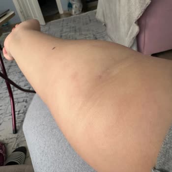 Evdesaglikhizmetleriniz (Instagram) Mağdur Etti