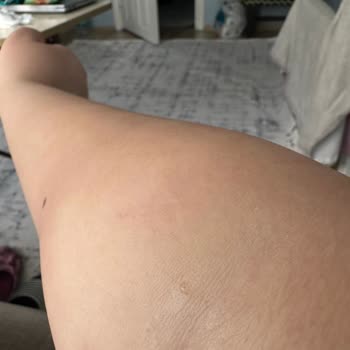 Evdesaglikhizmetleriniz (Instagram) Mağdur Etti