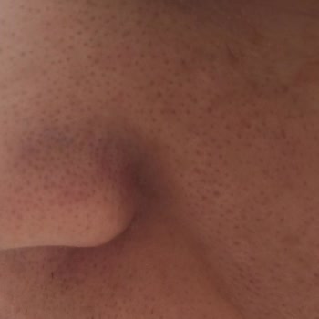 Nihan Ünsal Güzellik & Estetik Beklentilerin Altında Kaldı: Cilt Bakımı Hüsranı