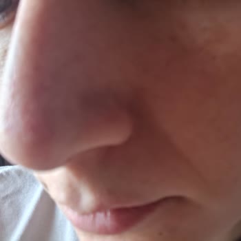 Nihan Ünsal Güzellik & Estetik Beklentilerin Altında Kaldı: Cilt Bakımı Hüsranı