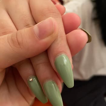 Aymira Koçaklı Yaşam Merkezi Protez Tırnak Memnuniyetsizliği