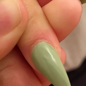 Aymira Koçaklı Yaşam Merkezi Protez Tırnak Memnuniyetsizliği