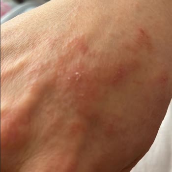 Trendyol Kiperin Collagen Peptides Vücutta Yan Etki Yaratıyor