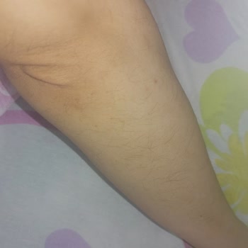 Miya Güzellik Merkezi (Beylikdüzü) Lazer Epilasyondan Memnun Kalmama