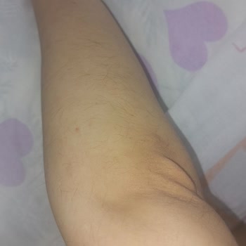 Miya Güzellik Merkezi (Beylikdüzü) Lazer Epilasyondan Memnun Kalmama