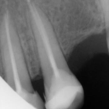 KlinikaDent Sağlığınızla Oynamak İçin Açılmış Kurum!