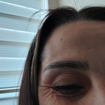 Aden Beauty Estetik ve Güzellik Merkezi Aden Göz Altlarımı Mahvetti!