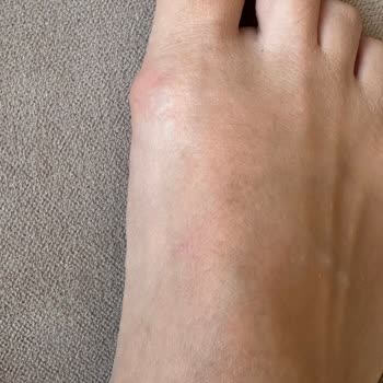 SuperStep Ve Converse Marka Ayakkabı Problemi