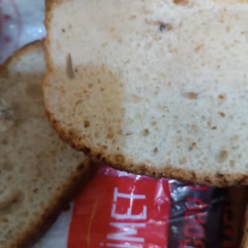 A101'de Şaşırtan Sağlıksız Ürün Deneyimi