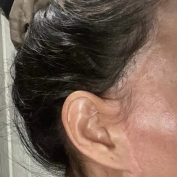 Sadokat Bekchanova (sadakat_hanim) Hanım Yüzümü Mahvetti!