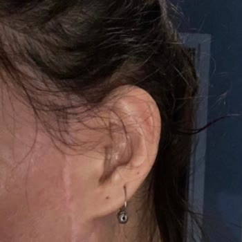 Sadokat Bekchanova (sadakat_hanim) Hanım Yüzümü Mahvetti!