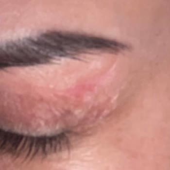 Sadokat Bekchanova (sadakat_hanim) Hanım Yüzümü Mahvetti!