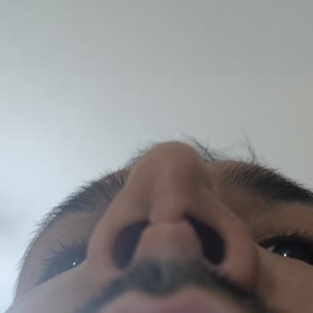 Dr. İbrahim Akın Burun Estetiği Mağduriyeti!