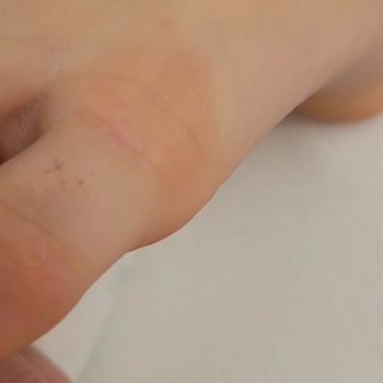 Zara Ayakkabısı Yüzünden 4 Yaşındaki Çocuğumun Ayakları Yara Oldu