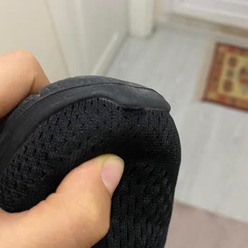 15 Günlük Ayakkabı Önden Açıldı, Skechers Ürünün Arkasında Durmuyor!