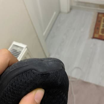 15 Günlük Ayakkabı Önden Açıldı, Skechers Ürünün Arkasında Durmuyor!