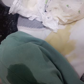 Sleepy Bebek Bezi Sızdırıyor.!