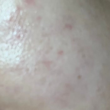 iyiyizbiz.com Orijinal Olmayan Ürün Solante