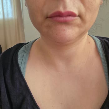 L'uva Aesthetics Fi Dokunuşu Etkisiz Ve Yanlış Fiyat Bilgisi