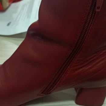 Camper 3 Ayda Derisi Ve Duruşu Bozula Bot