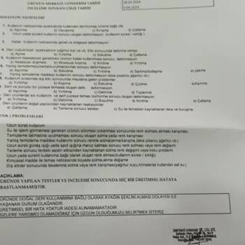 Camper 3 Ayda Derisi Ve Duruşu Bozula Bot