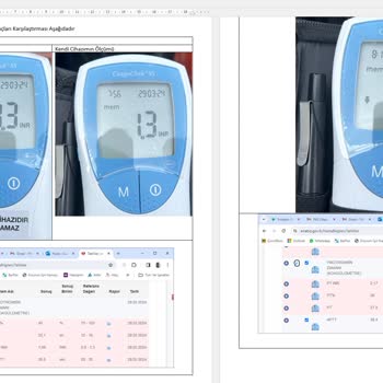Roche CoaguChek XS Cihazı Hayati Tehlike Oluşturuyor!