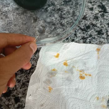 Falez Mutfak Eşyaları Tencere Kapak Camı Sıcağa Dayanıklı Değil Kırılıp Yemeğe Bulaştı