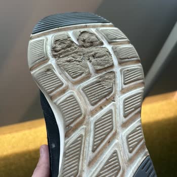 Skechers Ayakkabılarının Tabanın Çok Değişik Şekilde Erimesi