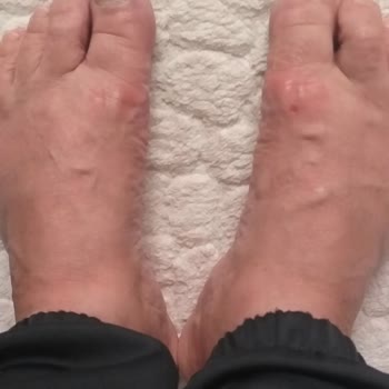 Tergan Deri Rahatlık Vaadiyle Alınan Terliğin Yarattığı Hayal Kırıklığı