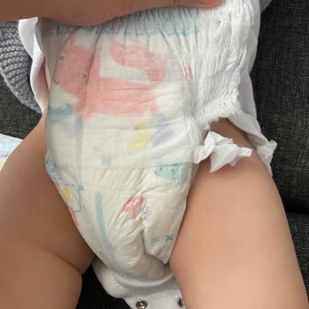 Prima Külot Bez Yırtılma Sorumu