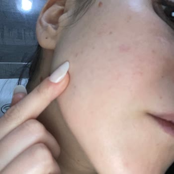 Caudalie Resveratrol Lift Serum Cildimi Mahvetti