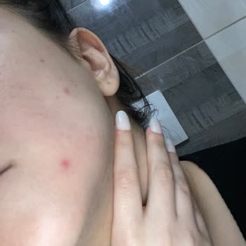 Caudalie Resveratrol Lift Serum Cildimi Mahvetti