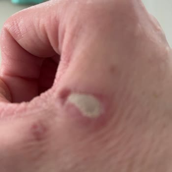 BİM Bozuk Süt Vücudumu Yaktı