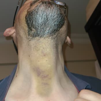 İstanbul Aydın Üniversitesi İstanbul'da Bir Diş Hastanesinde Yaşanan Olumsuz Deneyim