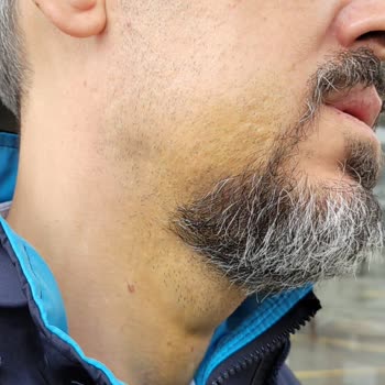 İstanbul Aydın Üniversitesi İstanbul'da Bir Diş Hastanesinde Yaşanan Olumsuz Deneyim