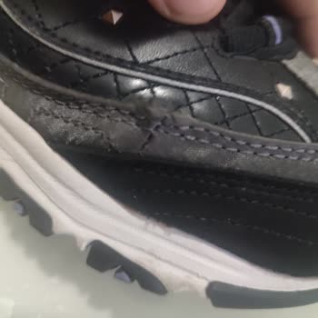Skechers Dan Bir Ayakkabı Mağduru Daha