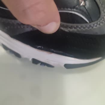 Skechers Dan Bir Ayakkabı Mağduru Daha