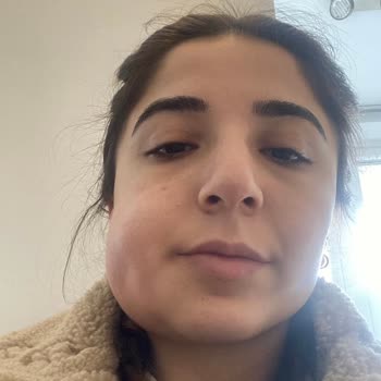 Beşiktaş Dentistanbul Gömülü Diş Çekimi