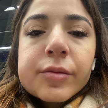 Beşiktaş Dentistanbul Gömülü Diş Çekimi