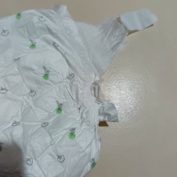 Sleepy Bebek Bezi Sızdırma Yapıyor Ve Cırtları Kopuk