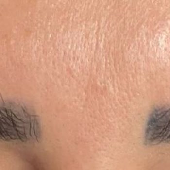 Fatih Sarıkaya Kuaför F**** S*******'NIN Kaşımda Normal Dövme Boyası Kullanması