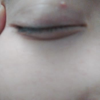 Gratis Beaulis Fondöten Gözümde Yağ Bezesi Çıkardı.