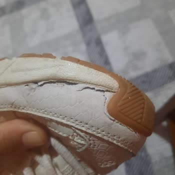 Skechers Ayakkabıda Deride Soyulma